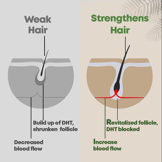 Matural - Hair Growth & Hair Fall Control Shampoo
